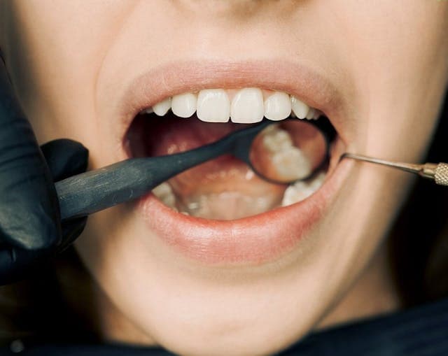 Dentist examining a patient's teeth during a general dentistry checkup