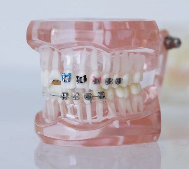 Patient with braces smiling confidently